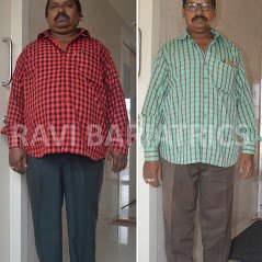 Ravi Bariatric and Obesity Clinic at Endocare - Ravi Bariatric and Obesity Clinic at Endocare