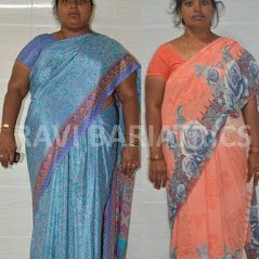 Ravi Bariatric and Obesity Clinic at Endocare - Ravi Bariatric and Obesity Clinic at Endocare