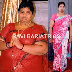Ravi Bariatric and Obesity Clinic at Endocare - Ravi Bariatric and Obesity Clinic at Endocare