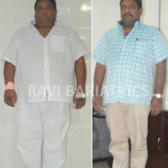 Ravi Bariatric and Obesity Clinic at Endocare - Ravi Bariatric and Obesity Clinic at Endocare