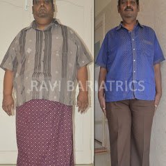 Ravi Bariatric and Obesity Clinic at Endocare - Ravi Bariatric and Obesity Clinic at Endocare