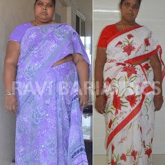 Ravi Bariatric and Obesity Clinic at Endocare - Ravi Bariatric and Obesity Clinic at Endocare