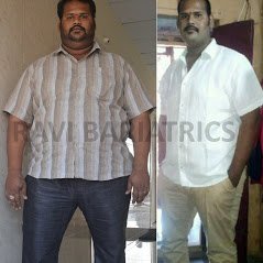 Ravi Bariatric and Obesity Clinic at Endocare - Ravi Bariatric and Obesity Clinic at Endocare