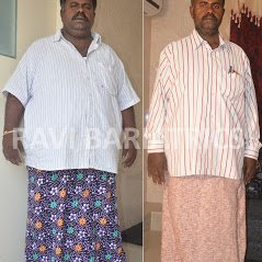 Ravi Bariatric and Obesity Clinic at Endocare - Ravi Bariatric and Obesity Clinic at Endocare