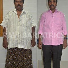 Ravi Bariatric and Obesity Clinic at Endocare - Ravi Bariatric and Obesity Clinic at Endocare