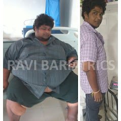 Ravi Bariatric and Obesity Clinic at Endocare - Ravi Bariatric and Obesity Clinic at Endocare