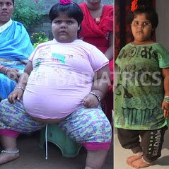 Ravi Bariatric and Obesity Clinic at Endocare - Ravi Bariatric and Obesity Clinic at Endocare