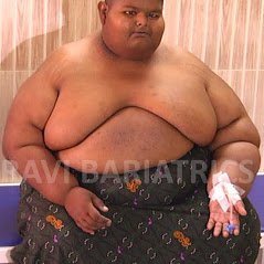 Ravi Bariatric and Obesity Clinic at Endocare - Ravi Bariatric and Obesity Clinic at Endocare