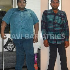 Ravi Bariatric and Obesity Clinic at Endocare - Ravi Bariatric and Obesity Clinic at Endocare