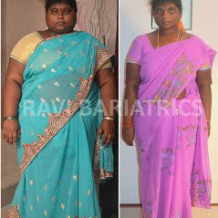 Ravi Bariatric and Obesity Clinic at Endocare - Ravi Bariatric and Obesity Clinic at Endocare