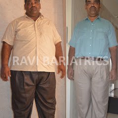Ravi Bariatric and Obesity Clinic at Endocare - Ravi Bariatric and Obesity Clinic at Endocare