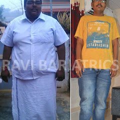 Ravi Bariatric and Obesity Clinic at Endocare - Ravi Bariatric and Obesity Clinic at Endocare