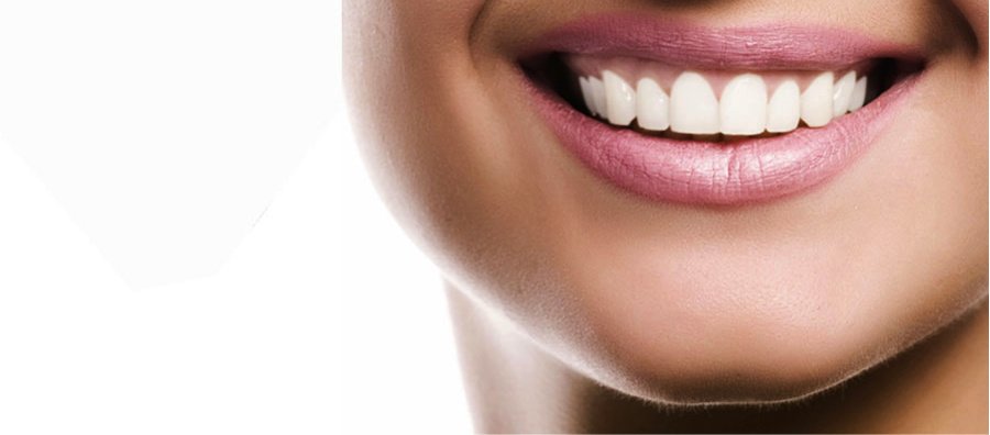 إعادة تعريف الأسنان - Redefine Dental
