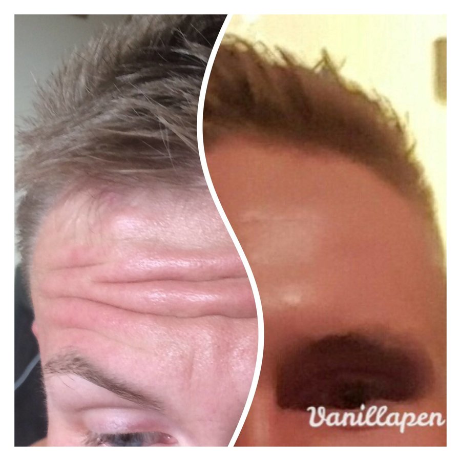 تحديث الحقن - Refresh Injections