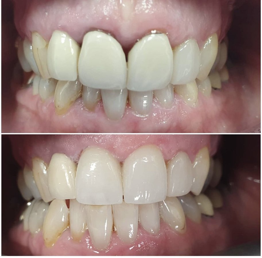 Regent Street Dental Practice - Regent Street Dental Practice