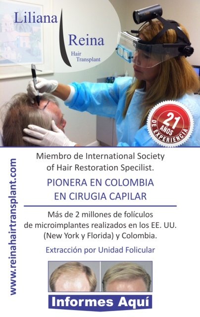 زرع الشعر رينا - Clinica D vinci Belleza y Salud - Reina Hair Transplant - Clinica D´vinci Belleza y Salud