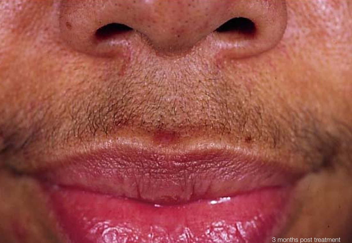 Rejuva Laser Hair Clinic - Rejuva Laser Hair Clinic