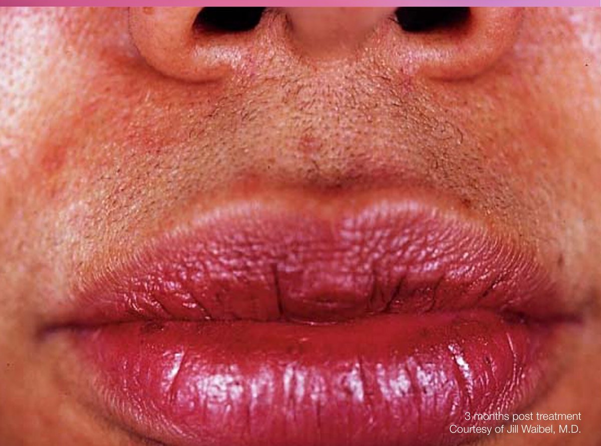 Rejuva Laser Hair Clinic - Rejuva Laser Hair Clinic