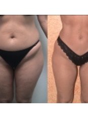 REJUVE PLASTIC SURGERY by Dr. Edgar Torres - REJUVE PLASTIC SURGERY by Dr. Edgar Torres