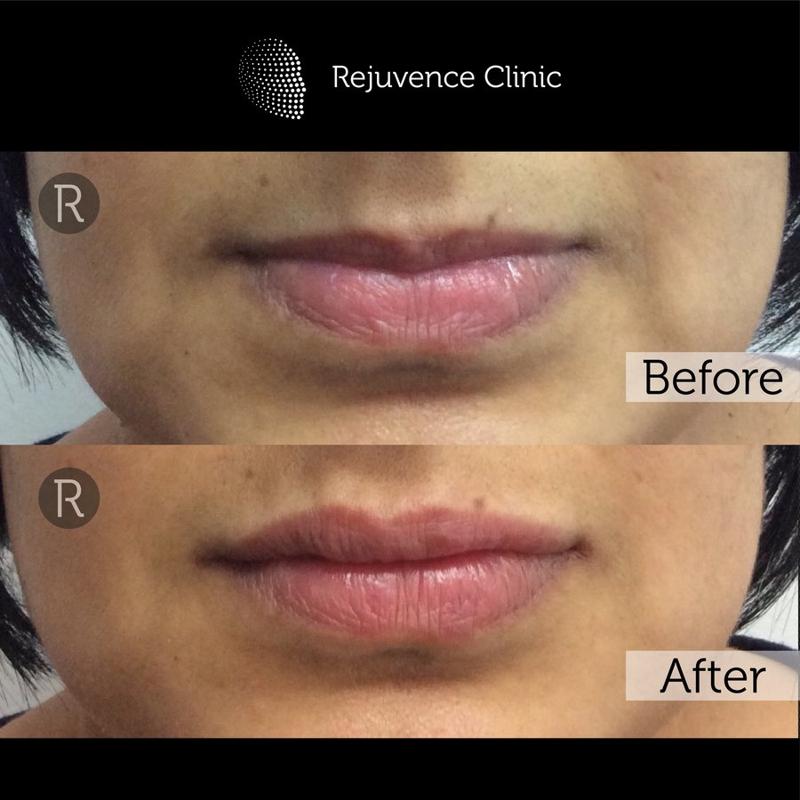 Rejuvence Clinic - Rejuvence Clinic