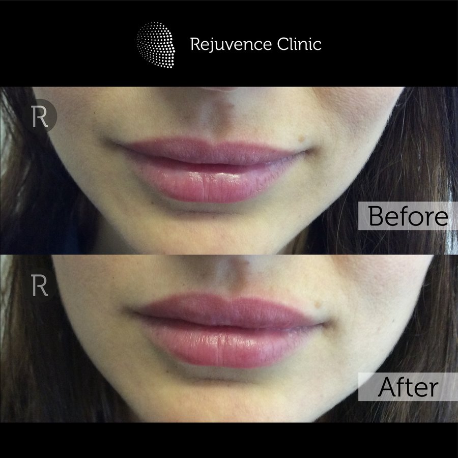 Rejuvence Clinic - Rejuvence Clinic