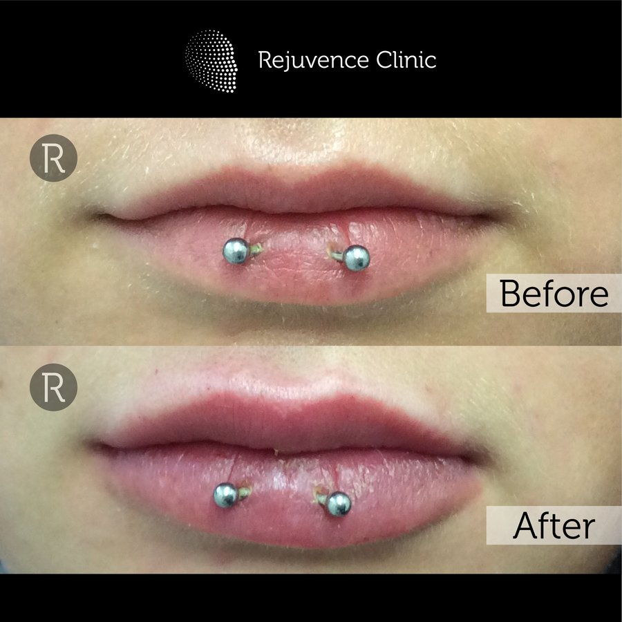 Rejuvence Clinic - Rejuvence Clinic