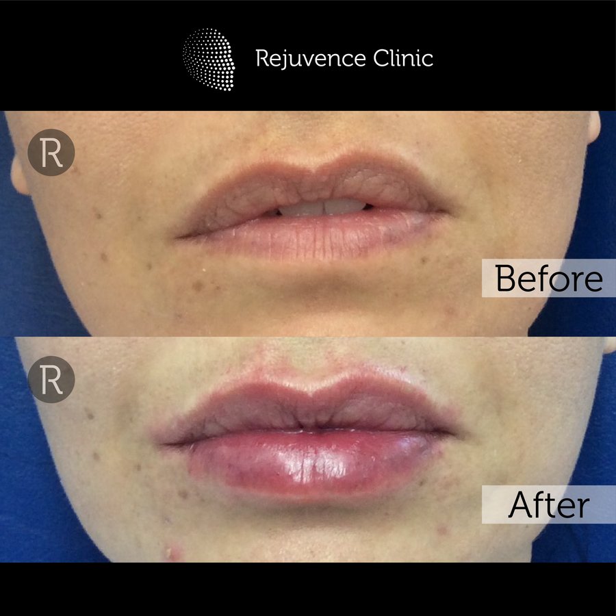 Rejuvence Clinic - Rejuvence Clinic