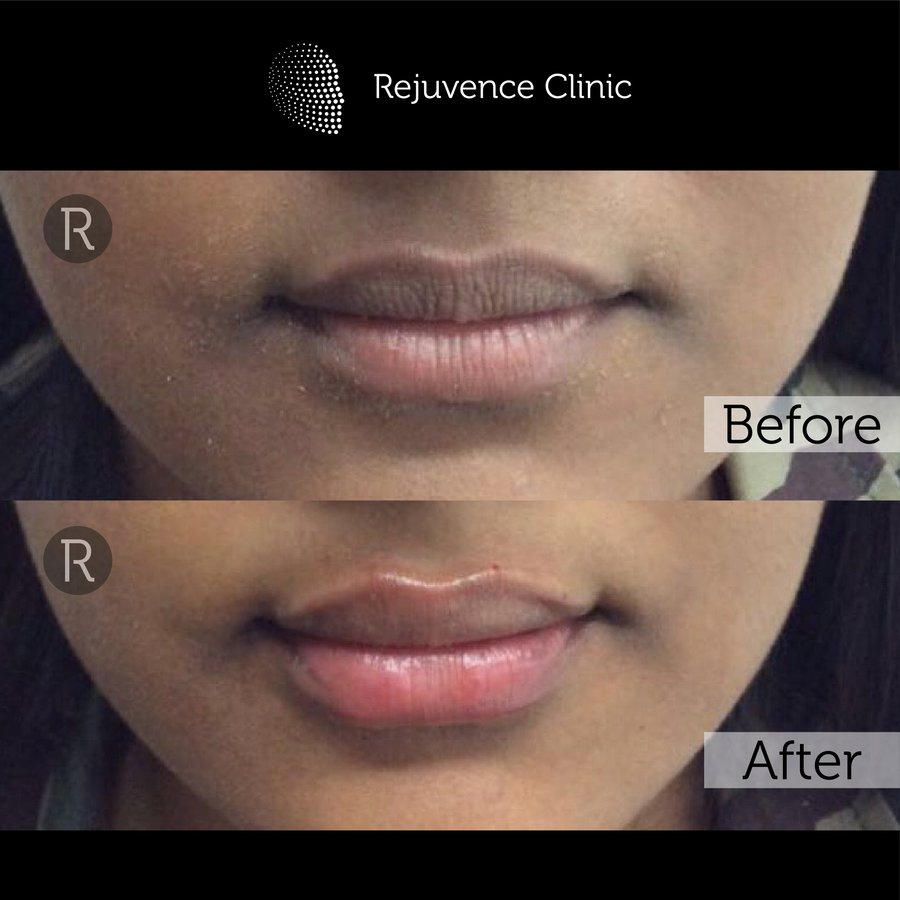 Rejuvence Clinic - Rejuvence Clinic