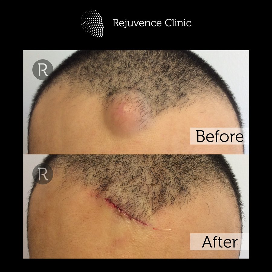 Rejuvence Clinic - Rejuvence Clinic