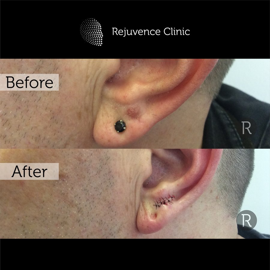 Rejuvence Clinic - Rejuvence Clinic