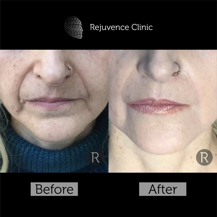 Rejuvence Clinic - Rejuvence Clinic