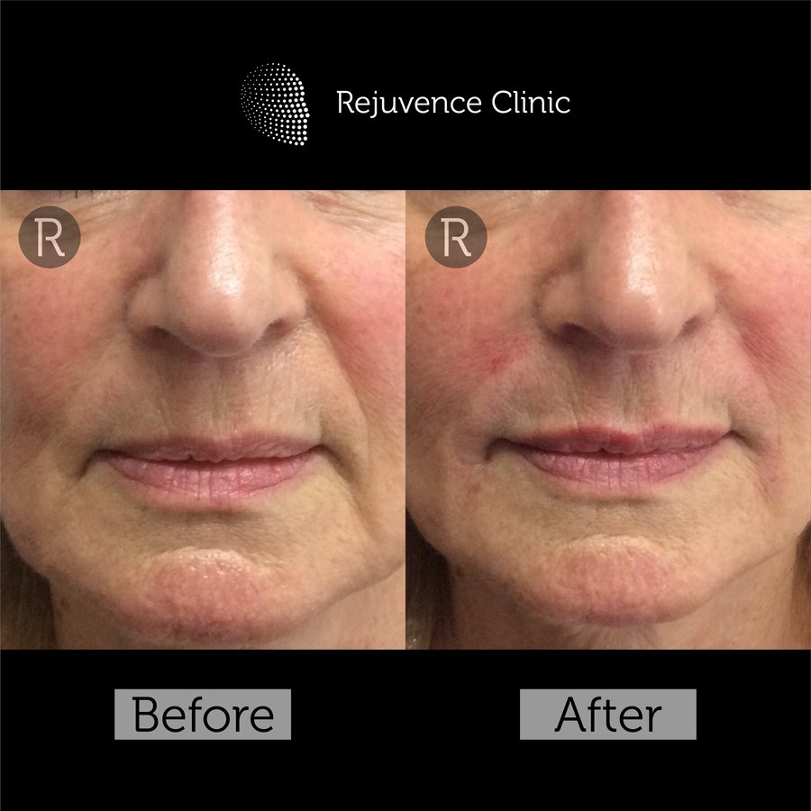 Rejuvence Clinic - Rejuvence Clinic