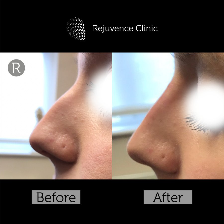 Rejuvence Clinic - Rejuvence Clinic