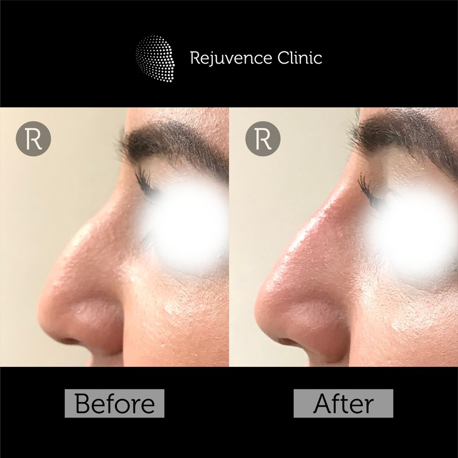 Rejuvence Clinic - Rejuvence Clinic