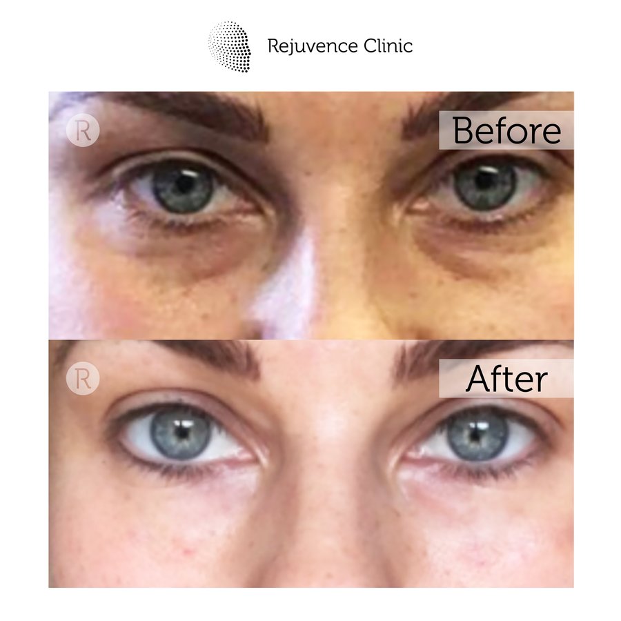 Rejuvence Clinic - Rejuvence Clinic