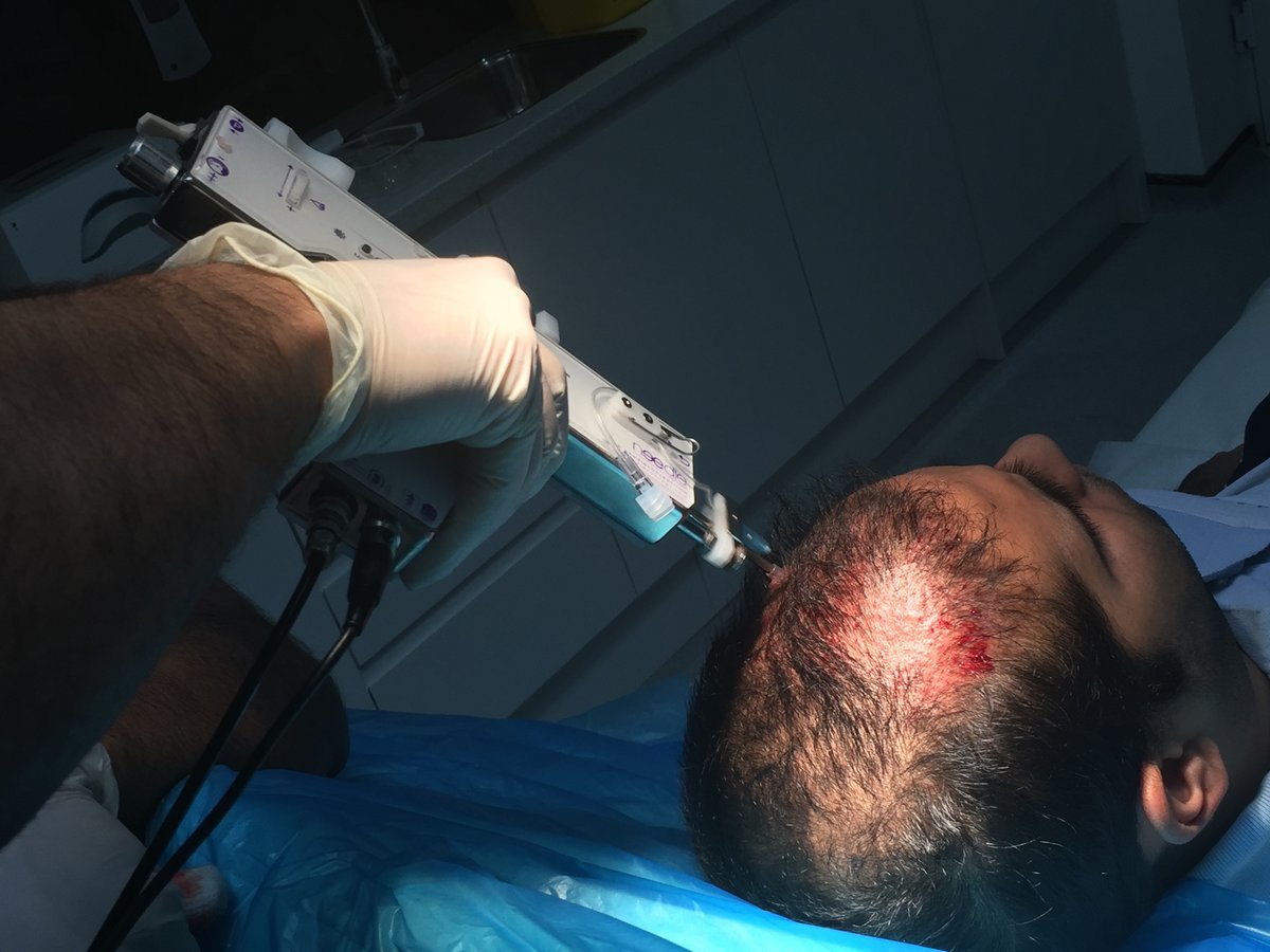 Rejuvence Clinic - Rejuvence Clinic