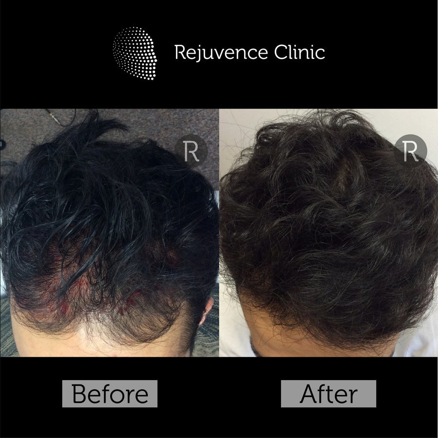 Rejuvence Clinic - Rejuvence Clinic