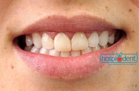 Renew Cancun - Renew Cancun