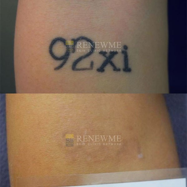 Renewme Skin Clinic Bangkok - Renewme Skin Clinic Bangkok