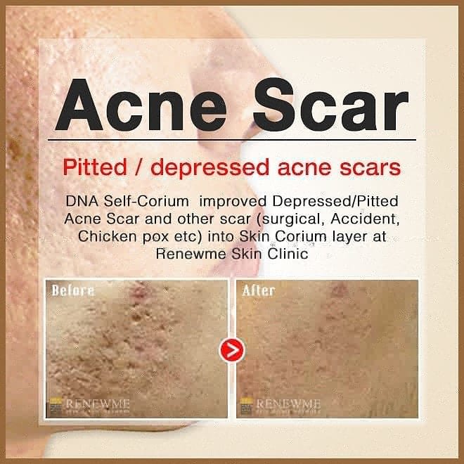 Renewme Skin Clinic Bangkok - Renewme Skin Clinic Bangkok
