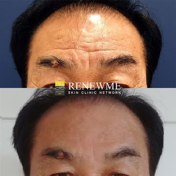 Renewme Skin Clinic Bangkok - Renewme Skin Clinic Bangkok