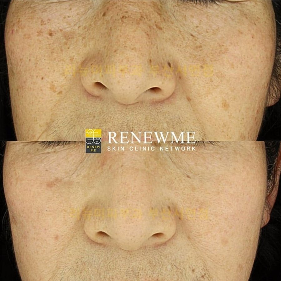 Renewme Skin Clinic Bangkok - Renewme Skin Clinic Bangkok