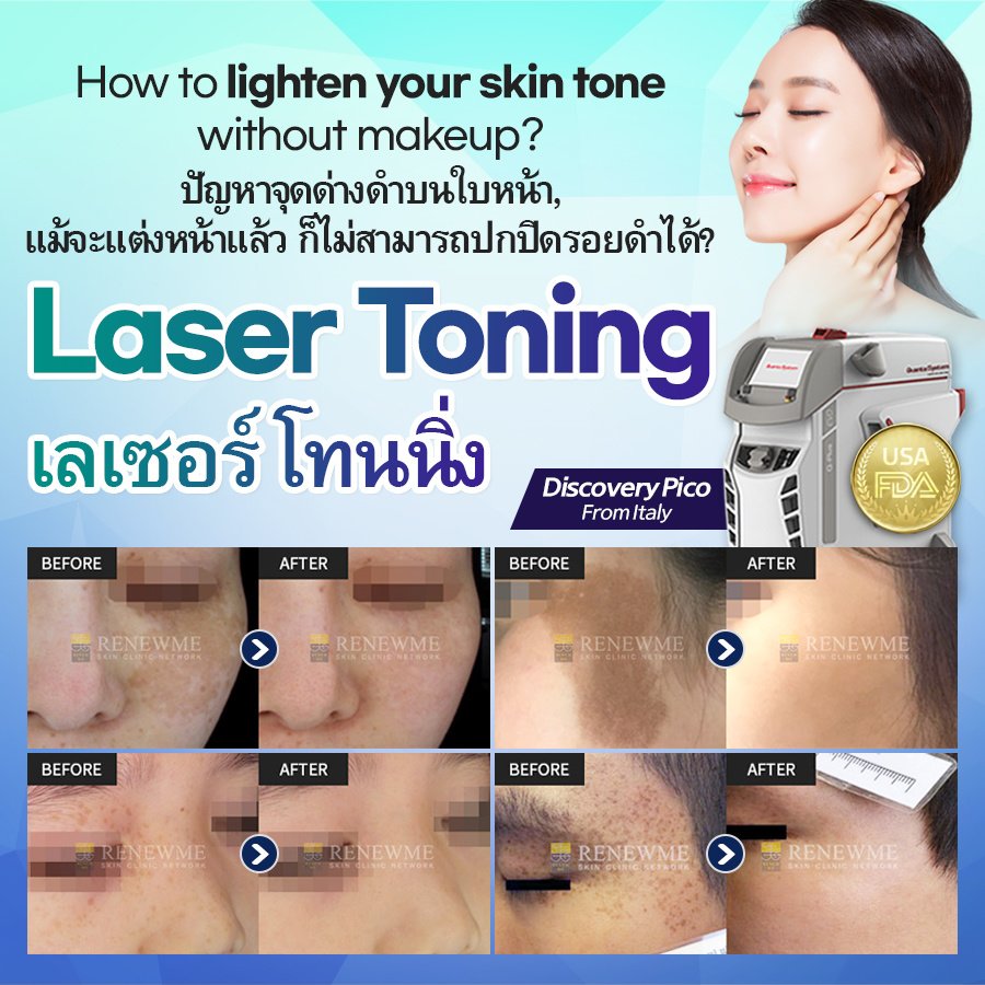 Renewme Skin Clinic Bangkok - Renewme Skin Clinic Bangkok