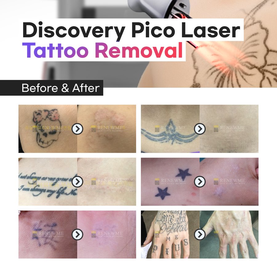 Renewme Skin Clinic Bangkok - Renewme Skin Clinic Bangkok