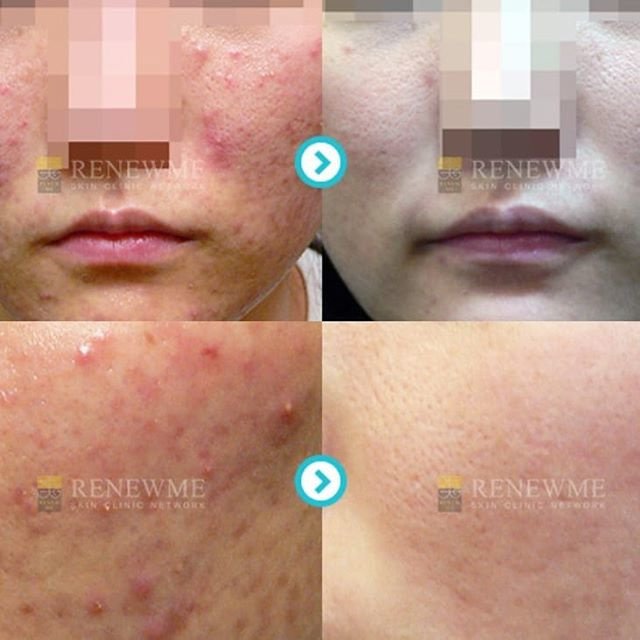 Renewme Skin Clinic Bangkok - Renewme Skin Clinic Bangkok