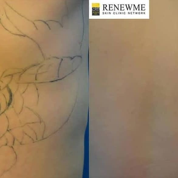 Renewme Skin Clinic Bangkok - Renewme Skin Clinic Bangkok