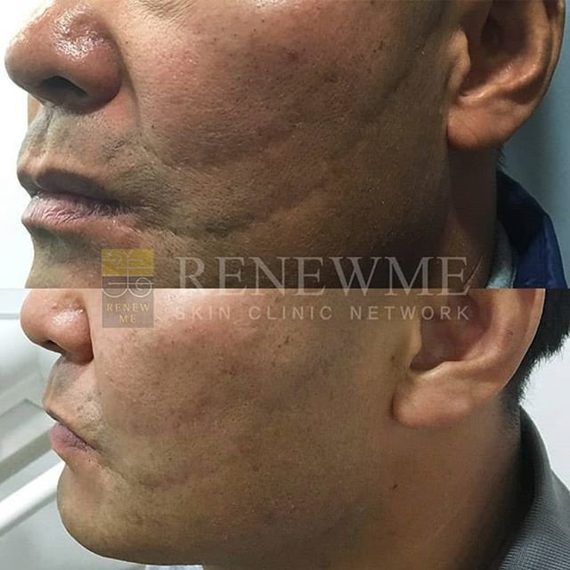 Renewme Skin Clinic Bangkok - Renewme Skin Clinic Bangkok