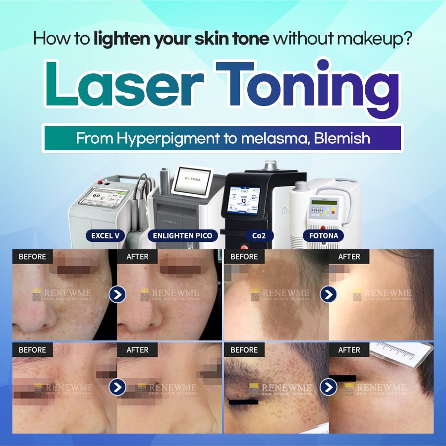 Renewme Skin Clinic Seocho - Renewme Skin Clinic Seocho