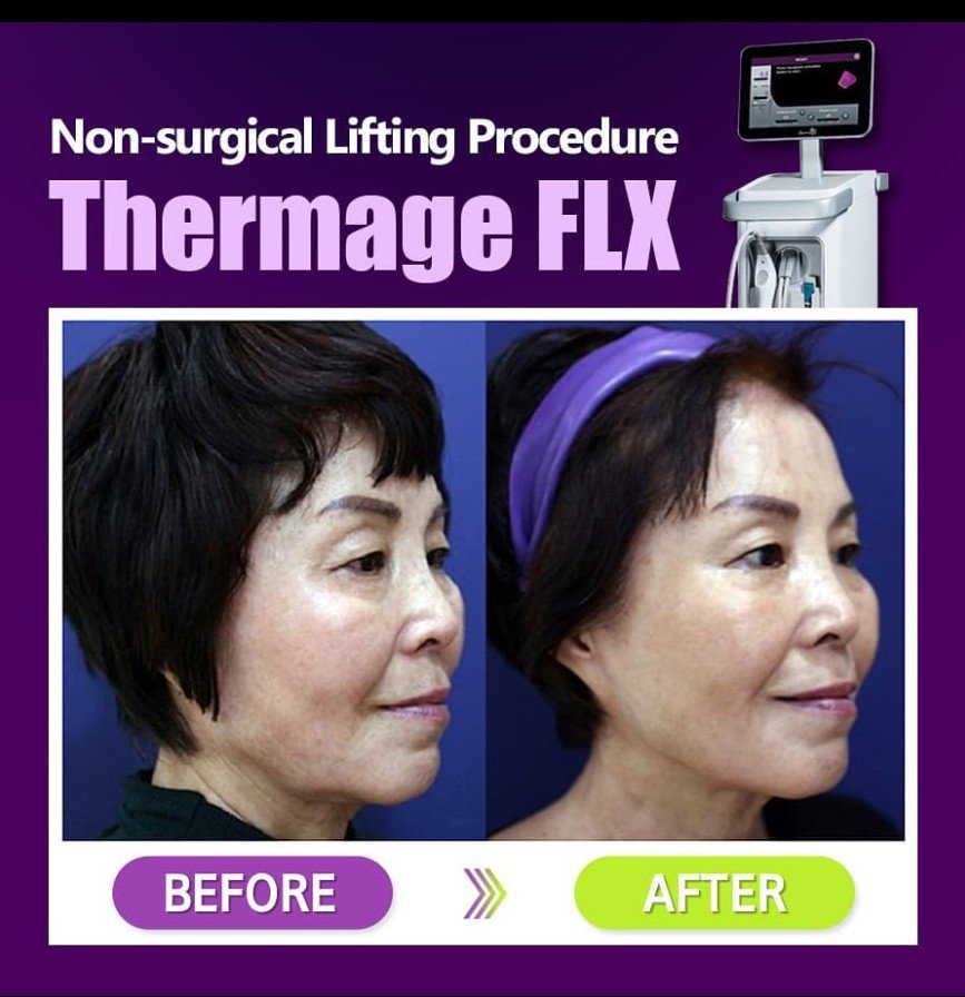 Renewme Skin Clinic Seocho - Renewme Skin Clinic Seocho