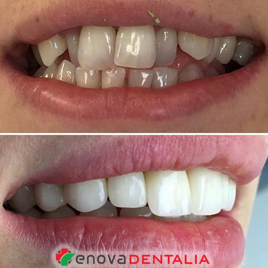 Renova Dental - Renova Dental